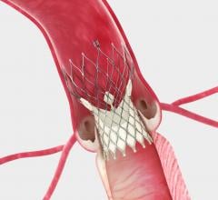 Medtronic CoreValve, real-world clinical outcomes, STS/ACC TVT Registry, TCT 2015