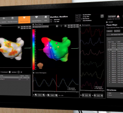 medtronic cardioinsight electromapping system, electoanatomical mapping, noninvasive ep mapping