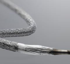 The FDA has cleared a new indication for the Medtronic Resolute Onyx Drug Eluting Stent, making it the first DES that only required one month of dual antiplatelet therapy (DAPT) in patients who are considered high risk for bleeding complications.