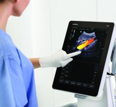 Mindray, TE7 Touch Enabled Ultrasound System, point of care, POC