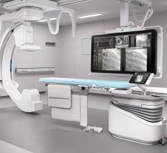 Philips, Azurion platform, angiography, interventional lab, global launch