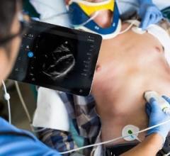 ASE, Echovation Challenge 2017, cardiovascular ultrasound, echocardiography, innovation