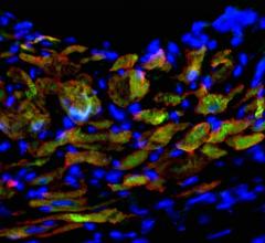 cardiac progenitor cells, UW-Madison study, mouse fibroblasts
