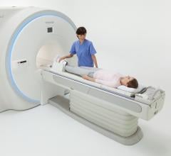 Toshiba Showcases Vantage Galan 3T MRI at ISMRM 2017
