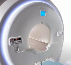 Toshiba Vantage Titan MRI Systems