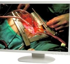 TRU-Vu Monitors, 24-inch, surgical, monitors, touch screens, MM-24 Series, MMZBTP-24 Series