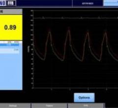 iFR Scout, pullback software, iFR Modality, fractional flow reserve, FFR