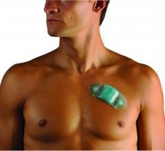 Wearable Holter Zio Patch  Atrial Fibrillation iRhythm Technologies 