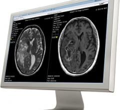 SyMRI, Cincinnati, CCHMC, synthetic MRI, pediatrics 