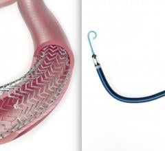 Two devices where safety is being called into question based on clinical data that is being questioned. The Cook Zilver PTX paclitaxel-eluting peripheral stent is among the devices included in a study questioning long-term safety of paclitaxel. The Abiomed Impella RP had higher than expected mortality in its post-approval study, possibly due to poor patient selection and implanting the device too late to aid the patient.