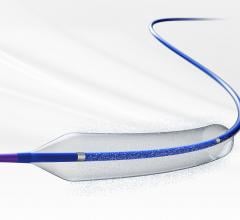iVascular Launches Essential Pro Coronary Drug-coated Balloon