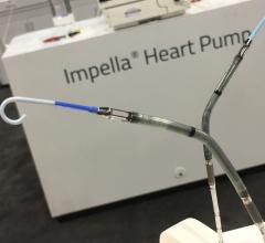 Two versions of the Abiomed Impella percutaneous ventricular assist device being shown at ACC 2018. Impella is the only device currently cleared by the FDA for use in cardiogenic shock. 
