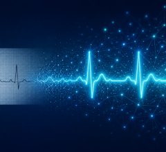 Turning ECG Data into Actionable Insight with AI