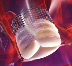 heart valve repair hybrid or cath lab