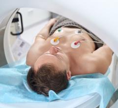 Coronary CT angiography reshapes cath lab planning and patient care.