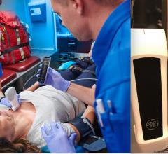 GE is integrating artificial intelligence into most of its imaging and information technology software. AI can aid fast critical care decision making. Above left is the vScan Air wireless point-of-care ultrasound system. It integrates AI for immediate, automated assessment of a patient's ejection fraction, right.
