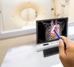 Coronary computed tomography angiography is a cheaper, less-invasive alternative to intravascular ultrasound in pharmaceutical clinical trials