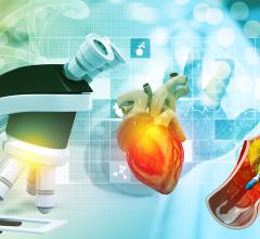 The global interventional cardiology device market is driven by the number of procedures performed across the globe