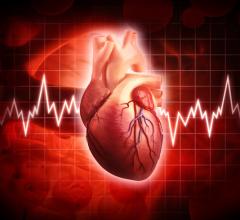 Emerging Novel Cardiac MR Imaging Biomarkers in Cardio-Vascular Rare Disease Clinical Trials  