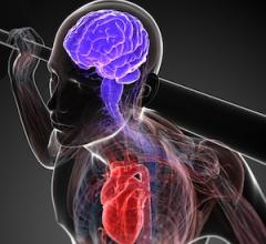 myocardial infarction, heart attack, immune system