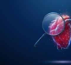 IVUS, cardiac imaging