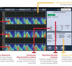 HeartSciences has been developing a new type of ECG system called Wavelet ECG that may offer a new way of looking at the heart. The MyoVista system uses continuous wavelet transform (CWT) signal processing to provide new frequency and energy information to detect cardiac relaxation abnormalities associated with left ventricular diastolic dysfunction commonly associated with hypertension, diabetes, valvular disease, ischemia, and reduced systolic function. Artificial intelligence is used to read the exam.