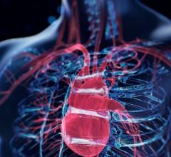 angiography, PCI, FFRangio