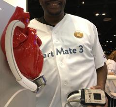 A patient who received HeartMate III LVAD system at ACC.18. The HeartMate 3 was the topic of of the the key late-breaking trials at #ACC18