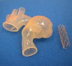 Children's Hospital of Michigan, Ariana Smith, aortic aneurysm, 3-D printing