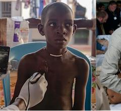 Two examples of hand-held, point-of-care-ultrasound (POCUS) being used to get immediate medical imaging information from patients in underserved areas. Left, a Butterfly Network system using an probe and an app turns a smartphone into an ultrasound system to image a patient at a remote African clinic. Right, a GE vScan being used to image patients in a rural community in Indian as part of an American Society of Echocardiography (ASE) outreach program.