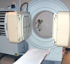Philips Medical System is recalling its older Forte Gamma Camera SPECT imaging systems due to the possibility of the detectors falling off of the unit onto the patient. The two gamma cameras can bee seen in this photo on either side of the patient bed. These can be rotated above the patient.