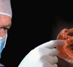 RealView's 3-D holographic projection of a heart 