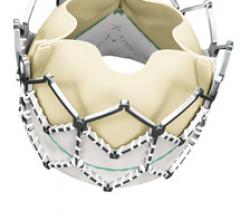 Edward Structural Heart Valve Repair Clinical Trial Sapien XT Transcatheter