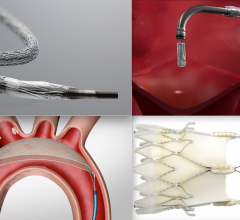 Some of the device technologies discussed in the TCT 2020 late-breaking trial sessions. Top left, the  Medtronic Resolute Onyx stent was the first stent to receive FDA clearance for short duration dual-antiplatelet therapy, which was a big topic and subject of several sessions. Lower left, the Keystone TriGuard 3 TAVR embolic protection device did not demonstrate superiority over TAVR without use of embolic protection. Top right, the Abbott MitraClip. Acurate neo TAVR valve. #TCTconnect #TCT2020