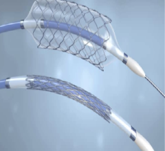 According to a new report from Allied Market Research, the global catheters market was valued at $22.7 billion in 2021, and is projected to reach $49.5 billion by 2031, growing at a CAGR of 8.1% from 2022 to 2031. 