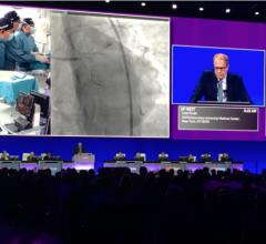 TCT 2021 Announces Late-Breaking Clinical Trials
