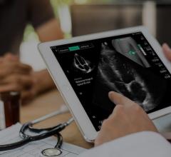 cardiac ultrasound, cardiac imaging