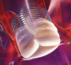 The Boston Scientific Lotus TAVR Valve