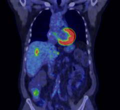 GE Healthcare Q.Clear Technology PET/CT Systems Nuclear Imaging