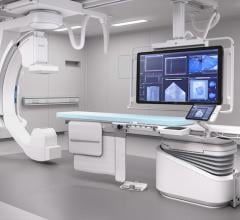 Philips Azurion angiography system, image-guided therapy system.