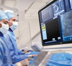 Philips released a new version of its iFR system that displays FFR readings as an overlay on live angiographic, angiogram images.
