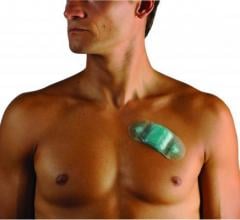 wearable Holter monitors, iRhythm, ziopatch, zio patch