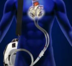 Syncardiac, driver, artificial heart 