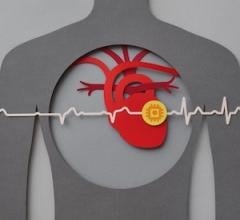 MRI, cardiac imaging, AI