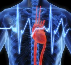 implantable cardioverter defibrillator, ep lab, leads, implantable devices