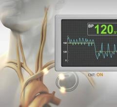 BackBeat CNT is the flagship therapy of Orchestra BioMed Inc. It is a bioelectronic treatment that immediately, substantially and chronically lowers blood pressure (BP) while simultaneously modulating the autonomic nervous system (ANS). 