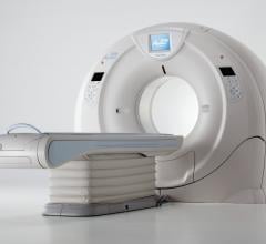 Oregon Health & Science University, OSHU, Toshiba Aquilion ONE ViSION Edition, CT, computed tomography