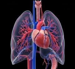 Polarean Expands Xenon MRI Platform into Cardiopulmonary Drug Development