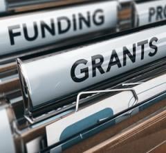 NIH Awards Grant to Help Improve Mitral Valve Surgery Decisions