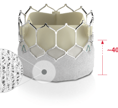 Edwards Lifesciences announced the launch of the SAPIEN 3 Ultra RESILIA valve, which incorporates Edwards' breakthrough RESILIA tissue technology with the industry-leading SAPIEN 3 Ultra transcatheter aortic heart valve. 